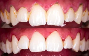 Mark P Tooth Transformation Image