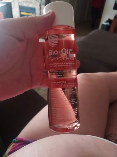 Bio Oil photo review