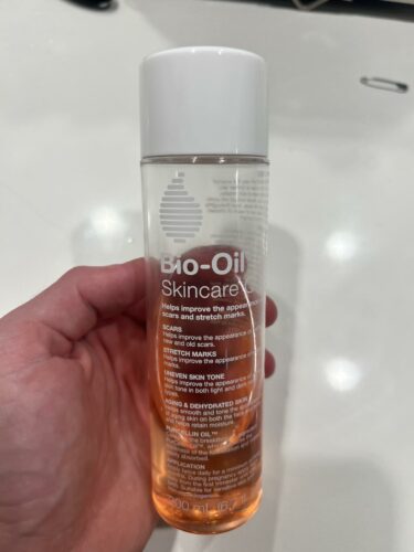 Bio Oil photo review