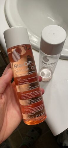 Bio Oil photo review