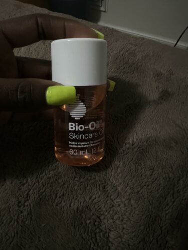 Bio Oil photo review