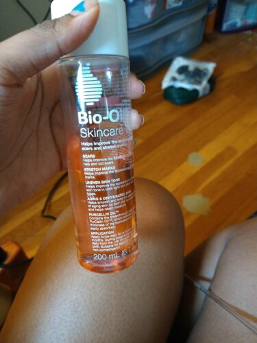 Bio Oil photo review