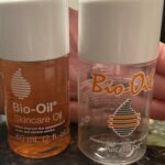 Bio Oil photo review