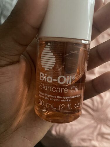 Bio Oil photo review