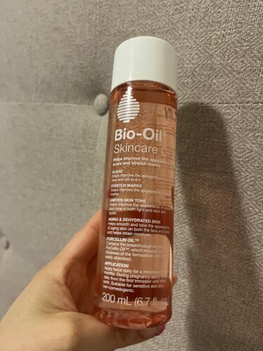 Bio Oil photo review